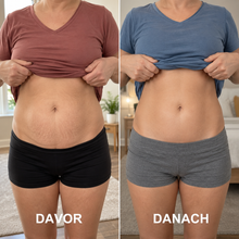 Lade das Bild in den Galerie-Viewer, Formkur - Anti-Cellulite- & Bindegewebs-Massagegerät