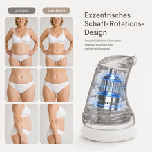 Lade das Bild in den Galerie-Viewer, Formkur - Anti-Cellulite- & Bindegewebs-Massagegerät