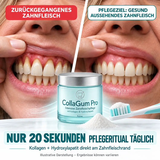 CollaGum Pro – Kollagen-Zahnfleischpflege für Reparatur, Aufbau & Regeneration