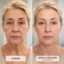 Lade das Bild in den Galerie-Viewer, LumaLift Pro - 3-in-1 Anti-Aging Lifting-Gerät für Gesicht &amp; Körper
